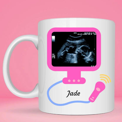 Mug personnalisé · Echographie - Bébé Fille détecté